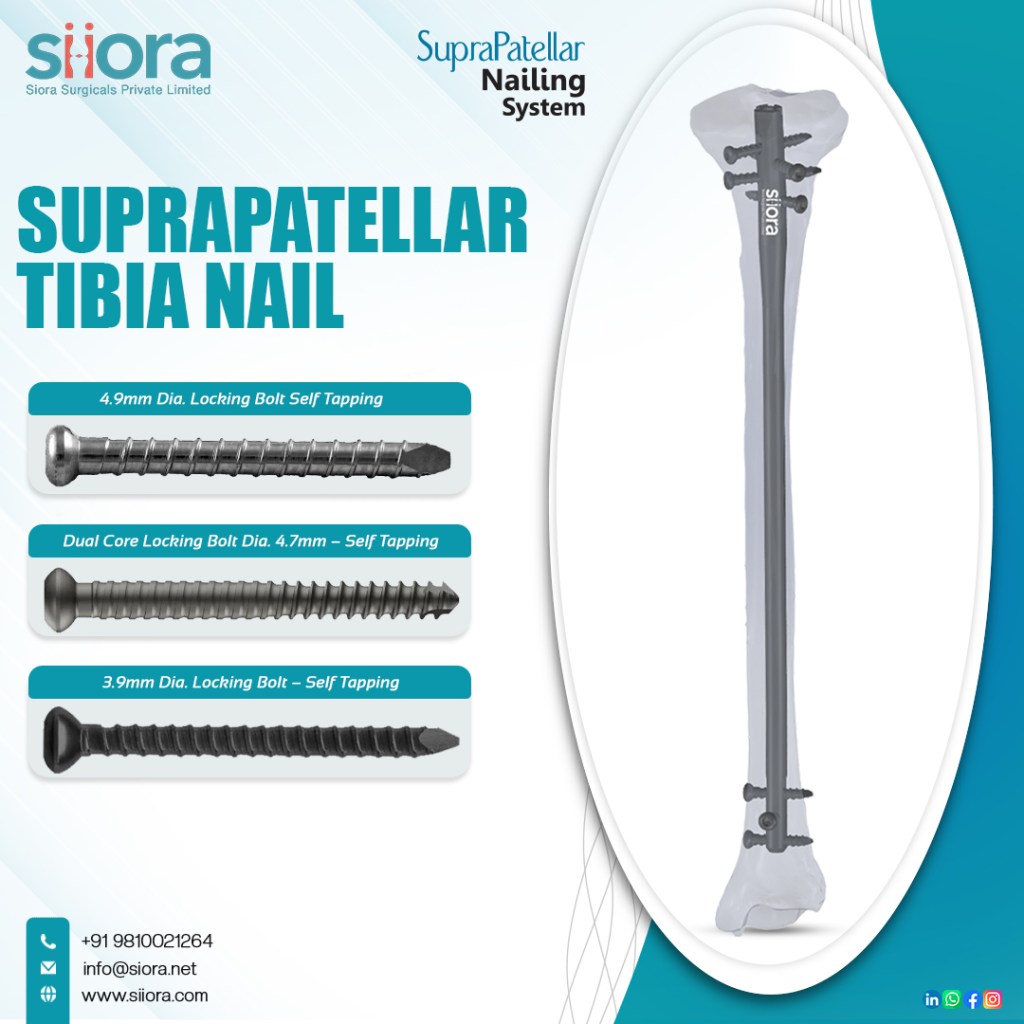 Suprapatellar Tibial Nail
